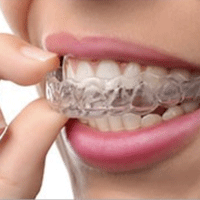 Invisalign