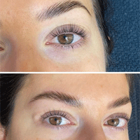Lash-Browlift 