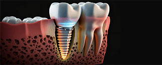 Tre Kronor Tandvård
